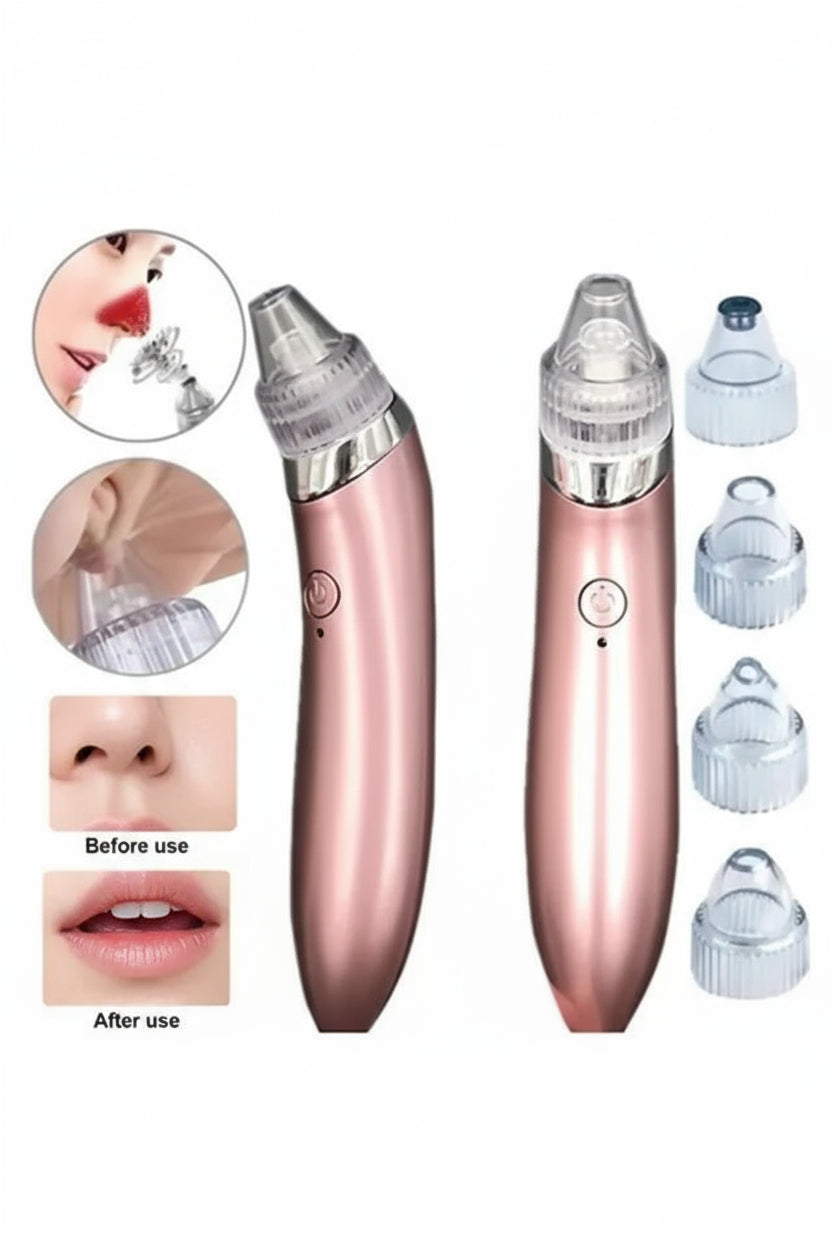 Blackhead Remover Vacuum – Acne Cleaner & Black Spot Extractor