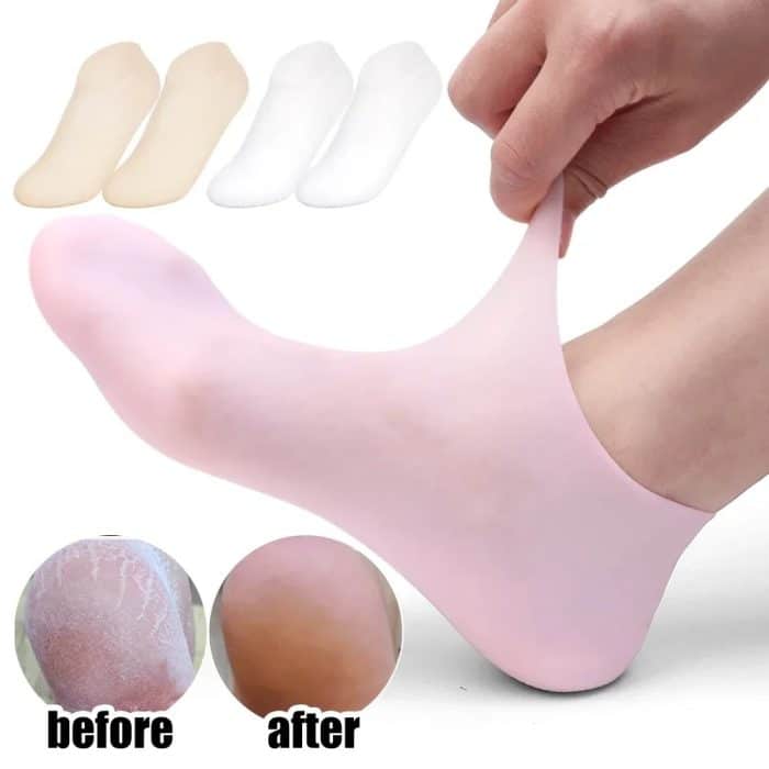 Silicone Gel Socks for Cracked Heels – Moisturizing Heel Sleeves for Dry Feet, Repair & Hydration