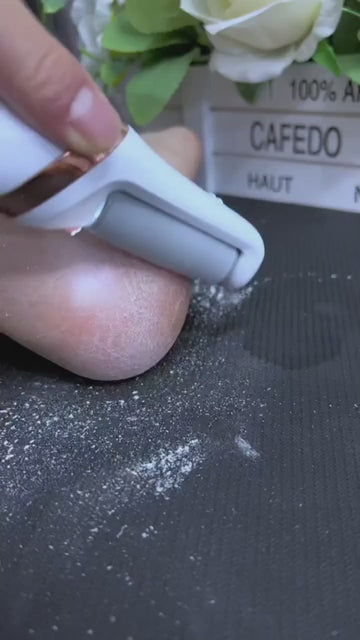 Rechargeable Callus Remover | Portable Electric Foot Care Device for Smooth, Soft Skin | Powerful Pedi Foot File