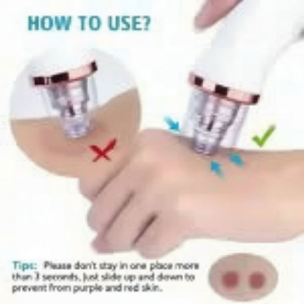 Vacuum Blackhead Remover Face Black Spots Cleaner White Dot Pimple Removal